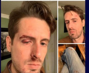 Patrons Attacked By Men Using Homophobic Slurs At Dallas Gay Bar